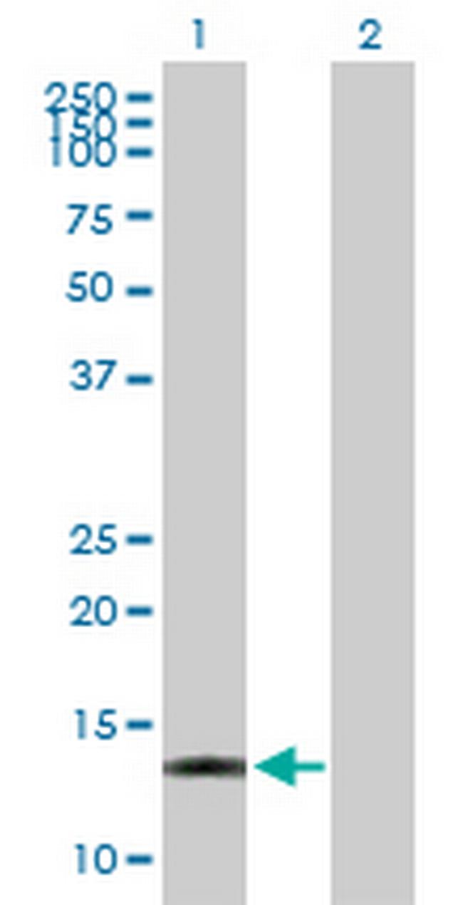 ACOT13 Antibody in Western Blot (WB)