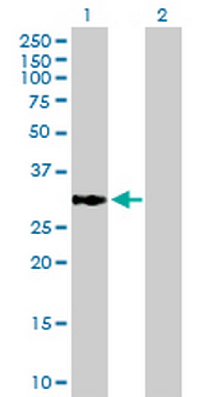 ECHDC1 Antibody in Western Blot (WB)