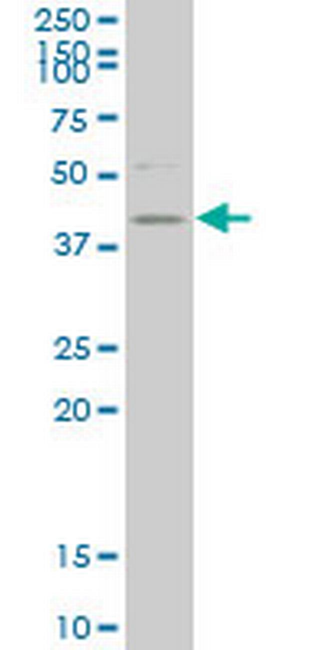 HDAC8 Antibody in Western Blot (WB)