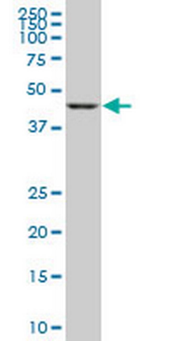 GSDML Antibody in Western Blot (WB)