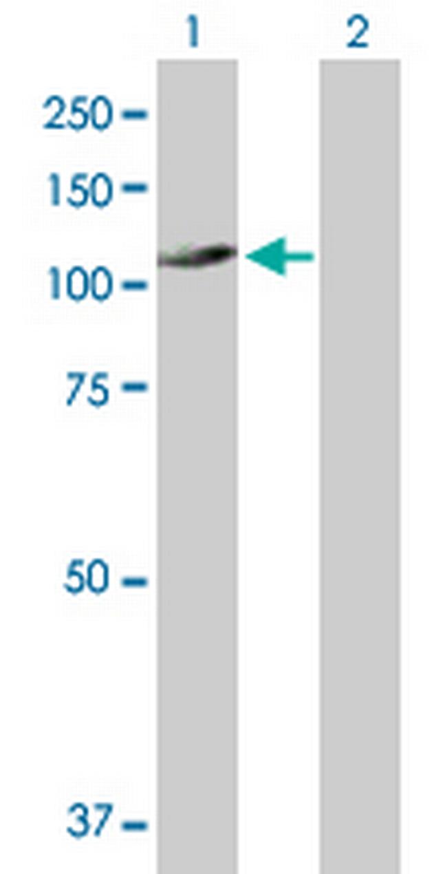 UNC45A Antibody in Western Blot (WB)