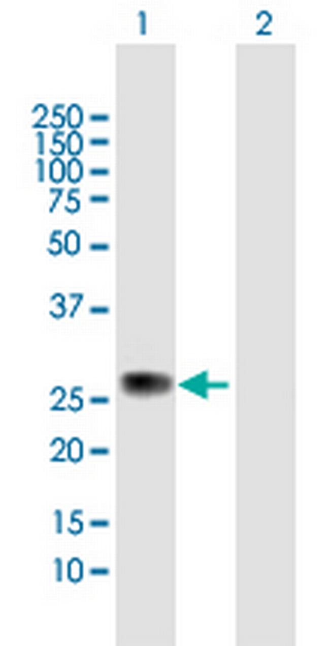 ZC4H2 Antibody in Western Blot (WB)