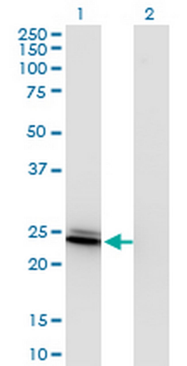 BIN3 Antibody in Western Blot (WB)