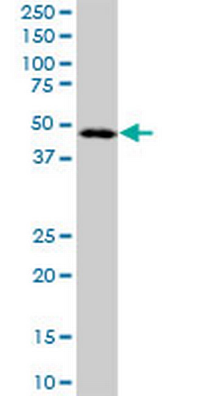 LANCL2 Antibody in Western Blot (WB)