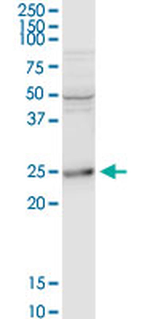 BCAP29 Antibody in Western Blot (WB)