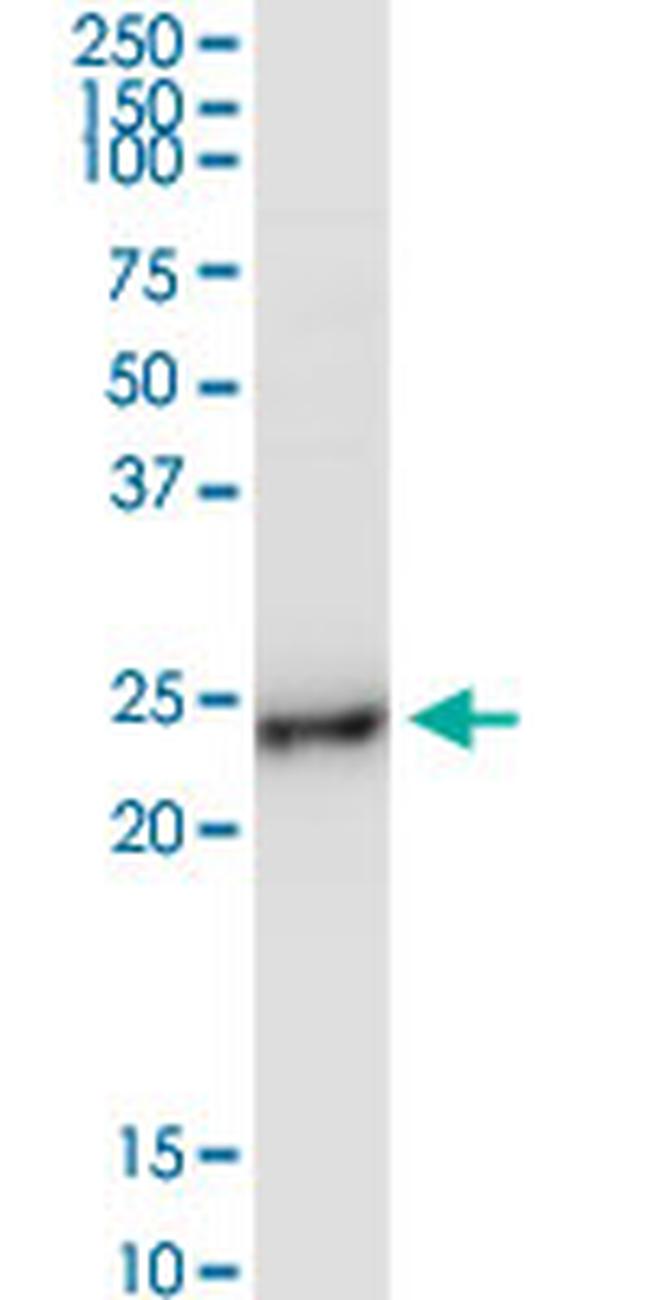 BCAP29 Antibody in Western Blot (WB)