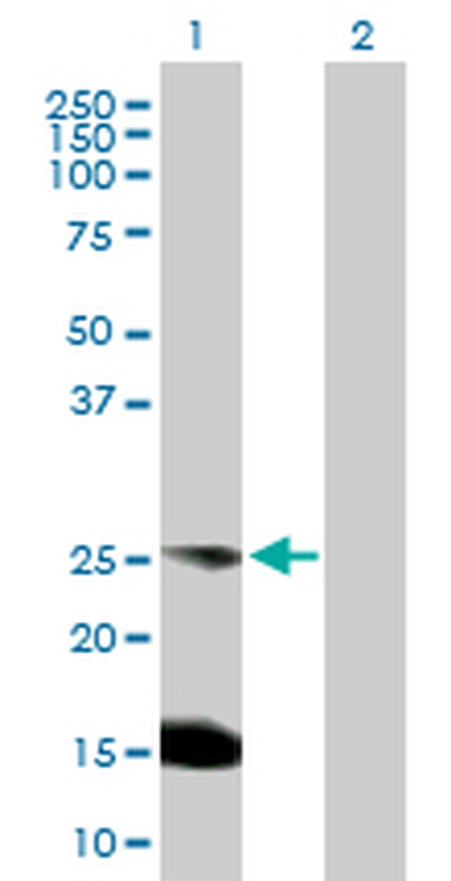 BCAP29 Antibody in Western Blot (WB)