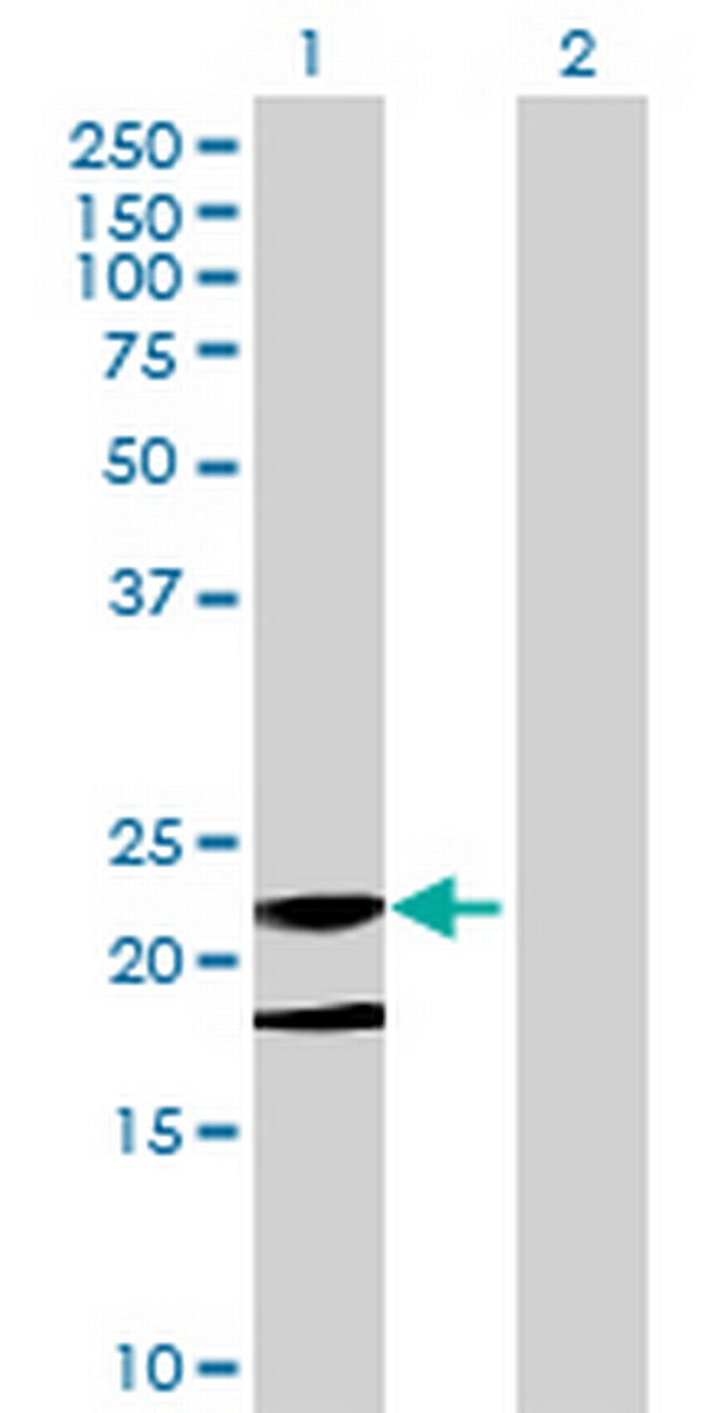 CFC1 Antibody in Western Blot (WB)