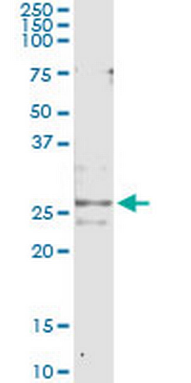 CFC1 Antibody in Immunoprecipitation (IP)