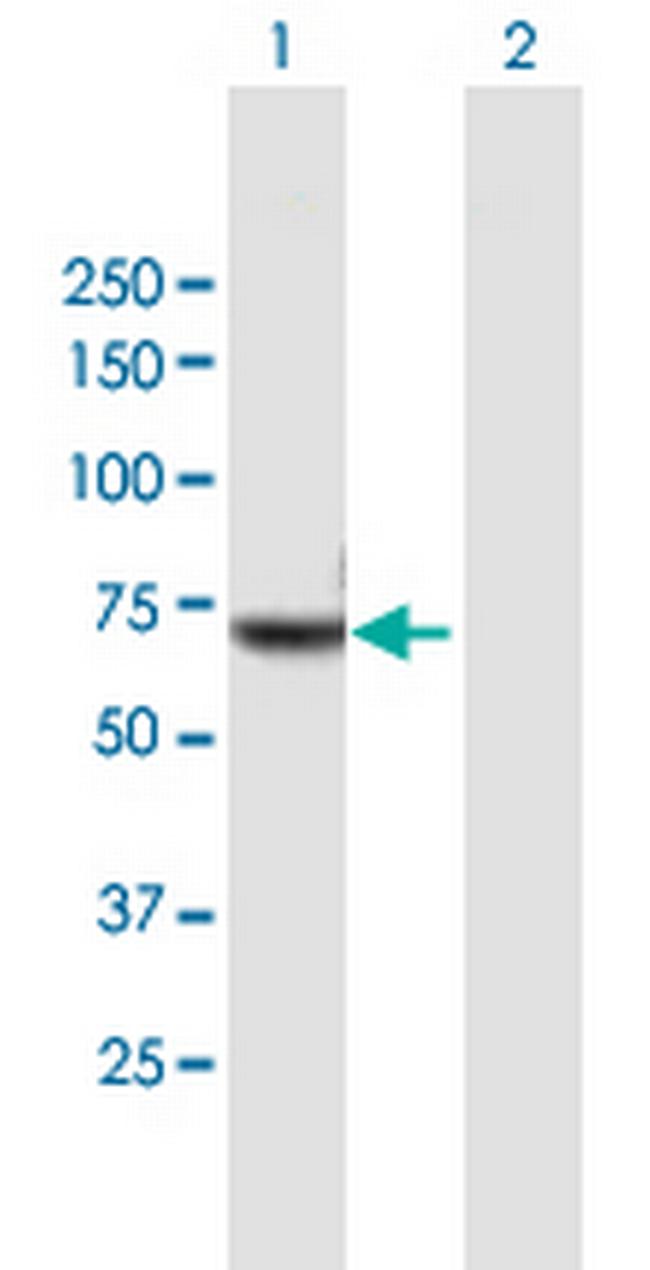 NXF2 Antibody in Western Blot (WB)