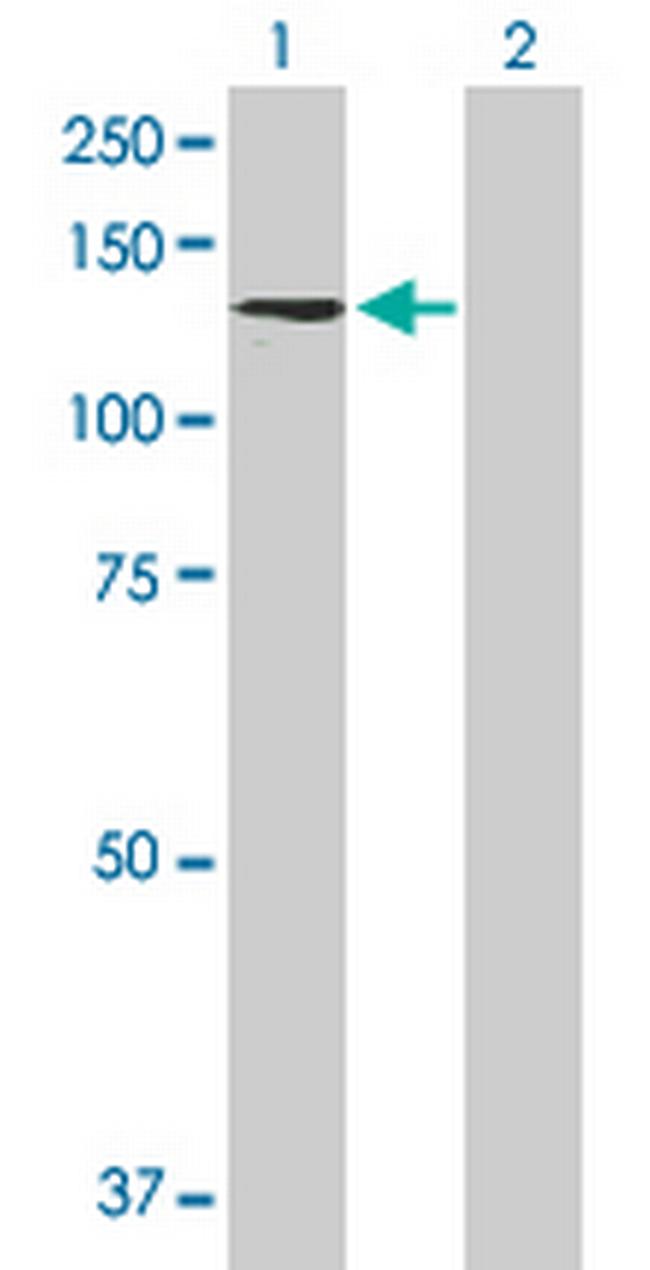 PCDHA6 Antibody in Western Blot (WB)