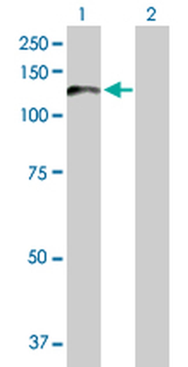 PCDHA6 Antibody in Western Blot (WB)