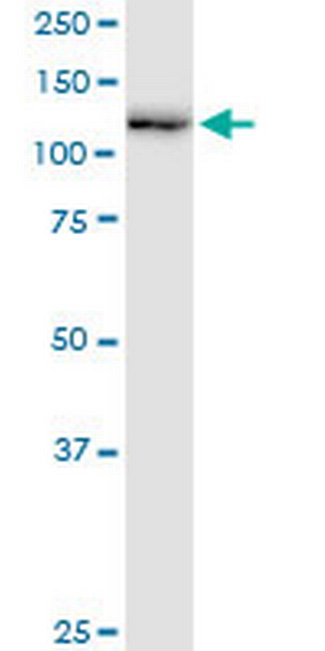 RNF20 Antibody in Western Blot (WB)