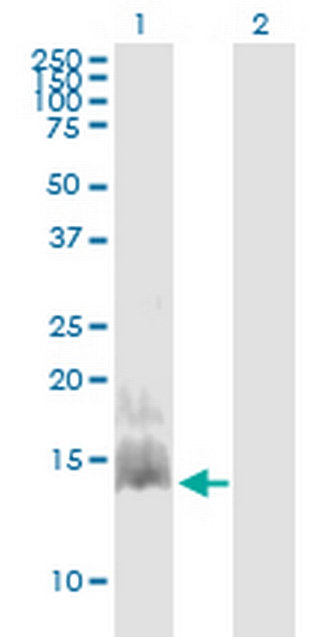 CCL28 Antibody in Western Blot (WB)