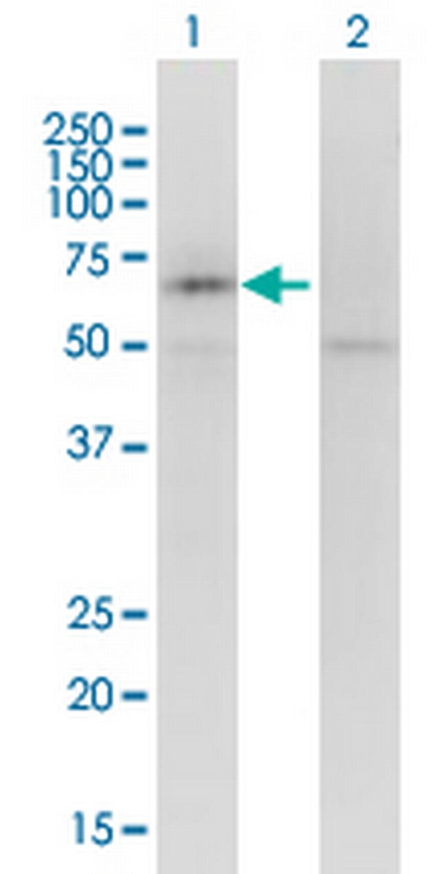 KCNQ5 Antibody in Western Blot (WB)