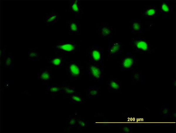 BCCIP Antibody in Immunocytochemistry (ICC/IF)