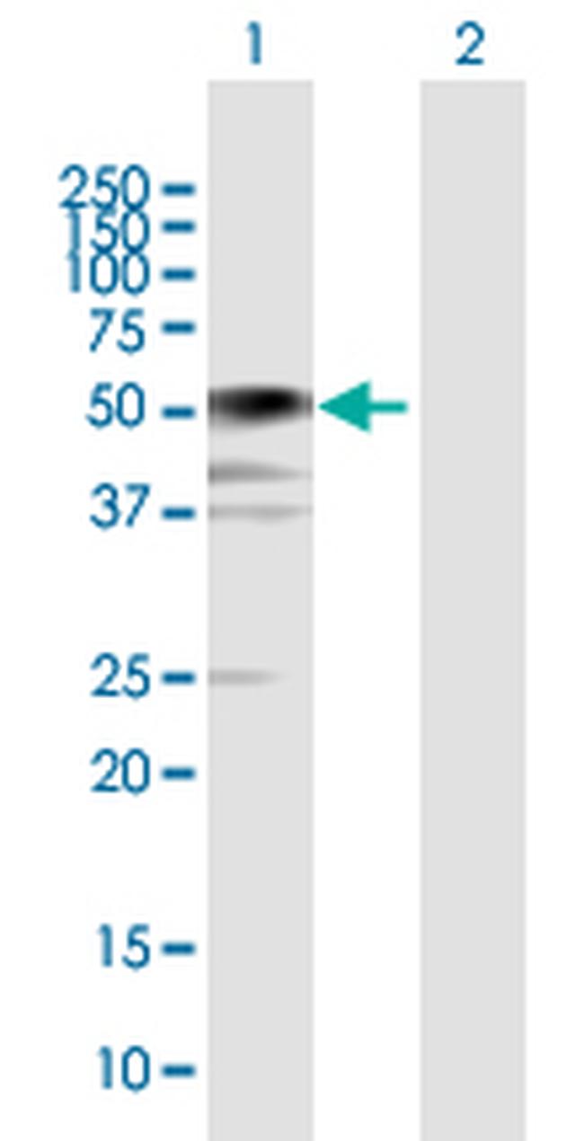 BCCIP Antibody in Western Blot (WB)