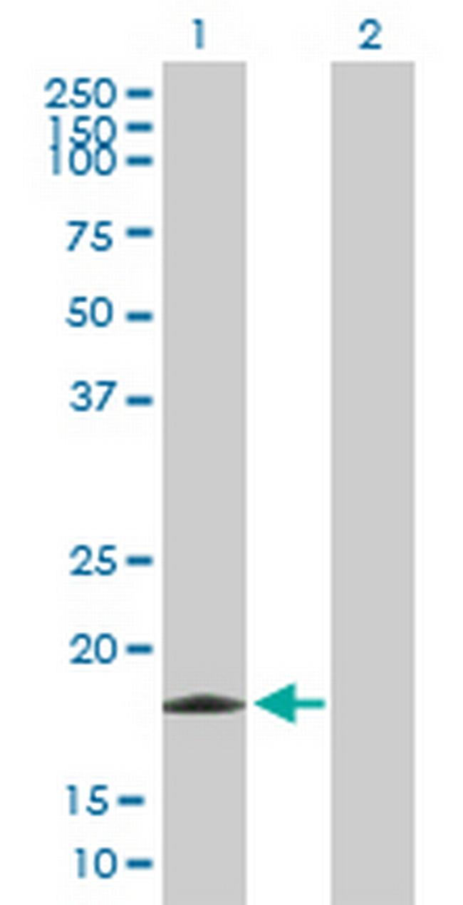 EIF5A2 Antibody in Western Blot (WB)