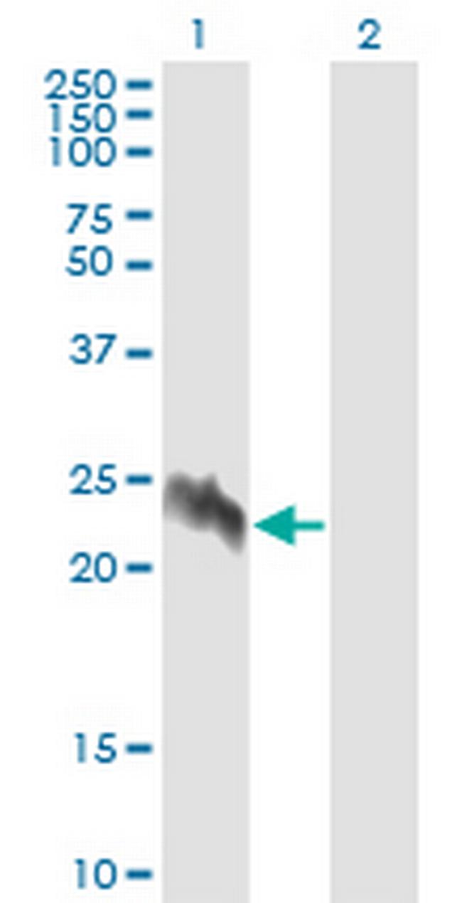 EIF5A2 Antibody in Western Blot (WB)