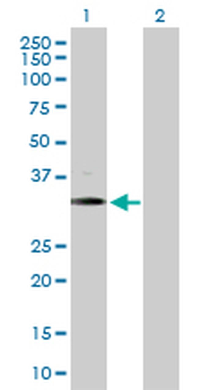 BARHL1 Antibody in Western Blot (WB)