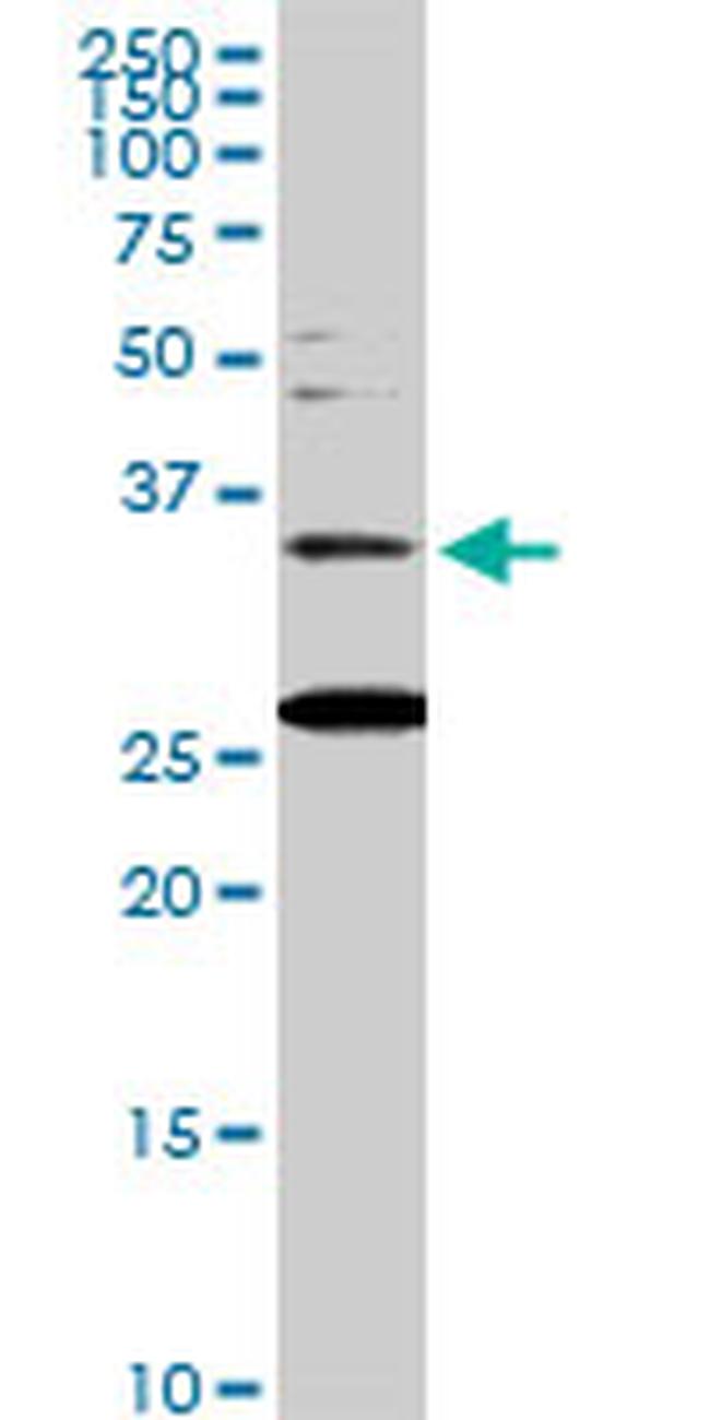 BARHL1 Antibody in Western Blot (WB)