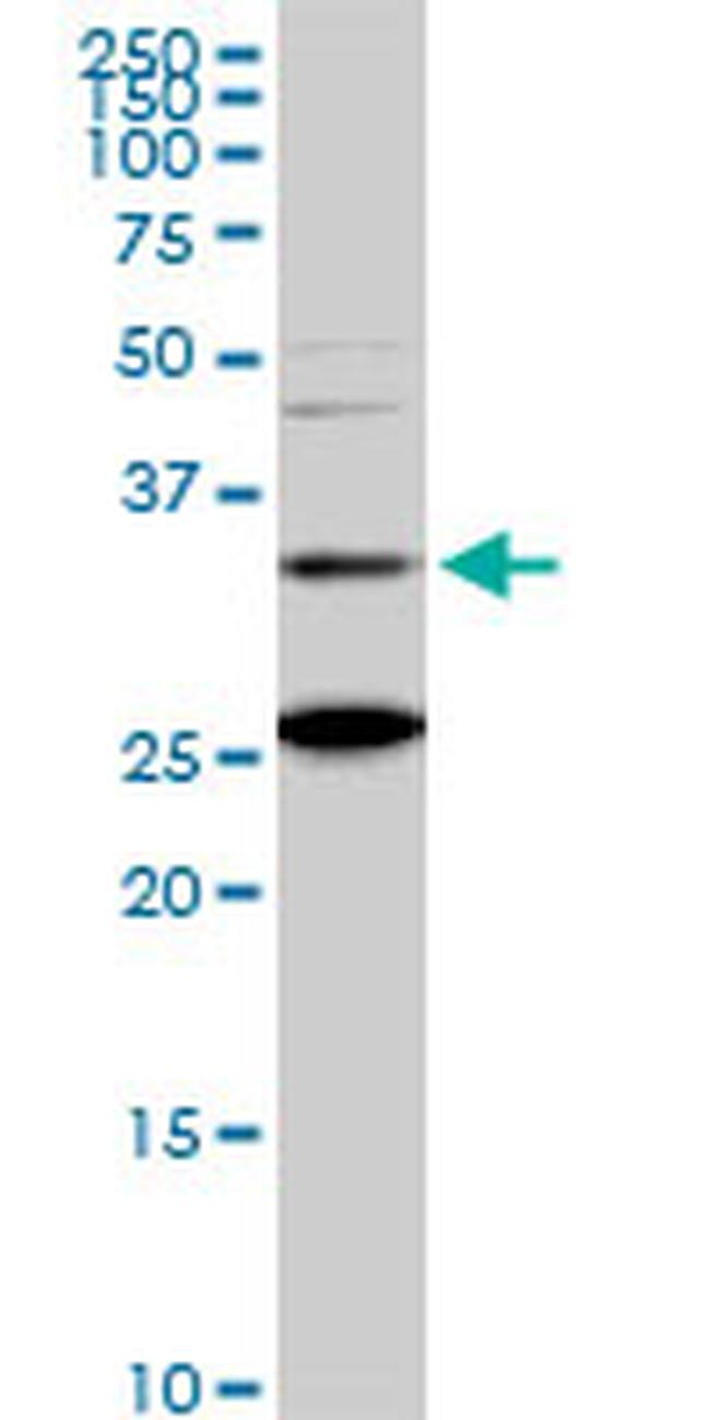 BARHL1 Antibody in Western Blot (WB)