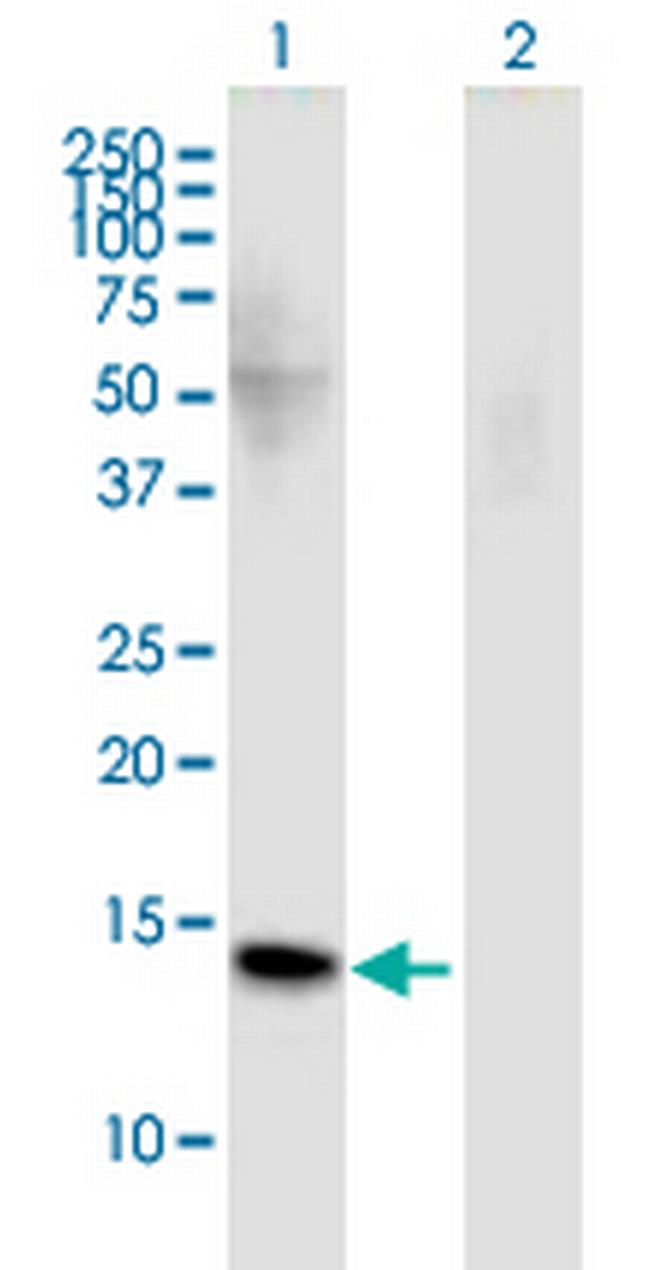 FMN2 Antibody in Western Blot (WB)