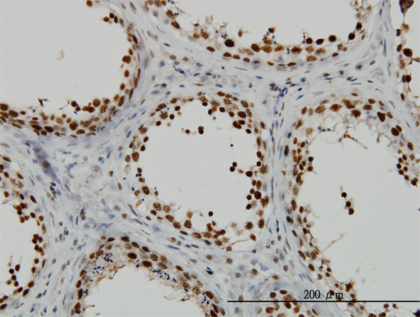 RAD18 Antibody in Immunohistochemistry (Paraffin) (IHC (P))