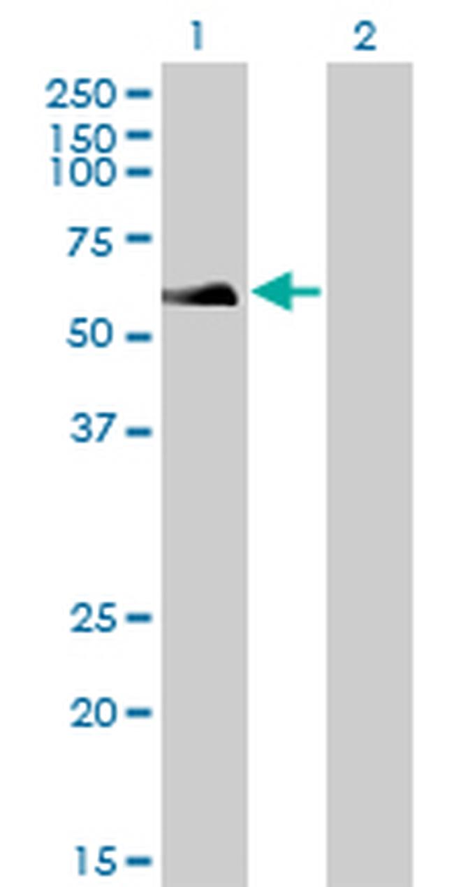 RAD18 Antibody in Western Blot (WB)