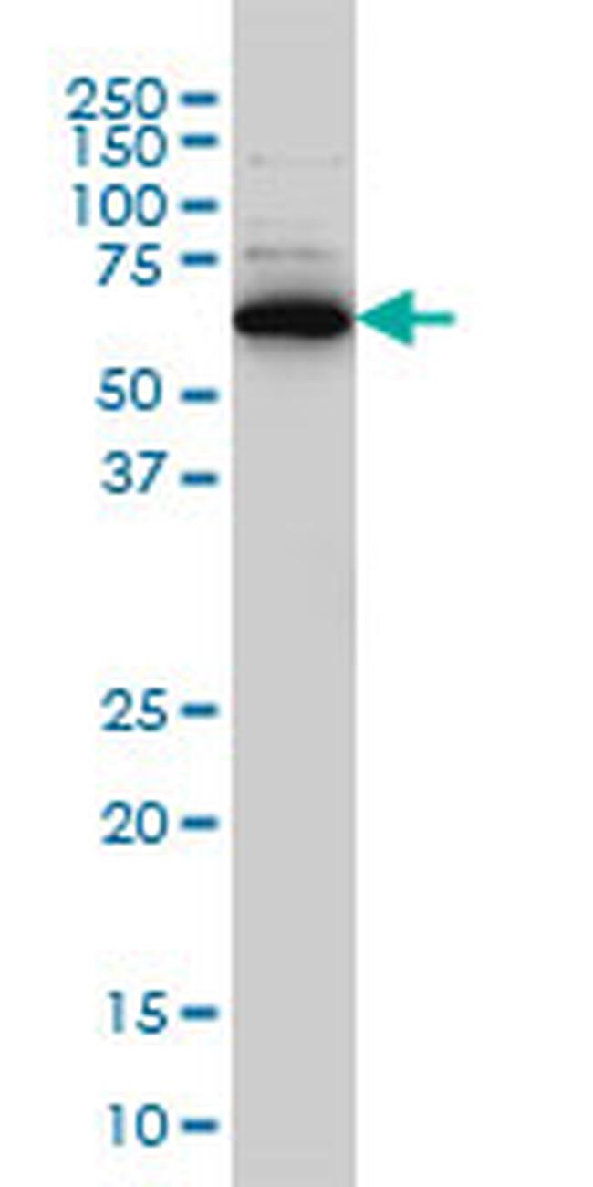 RAD18 Antibody in Western Blot (WB)