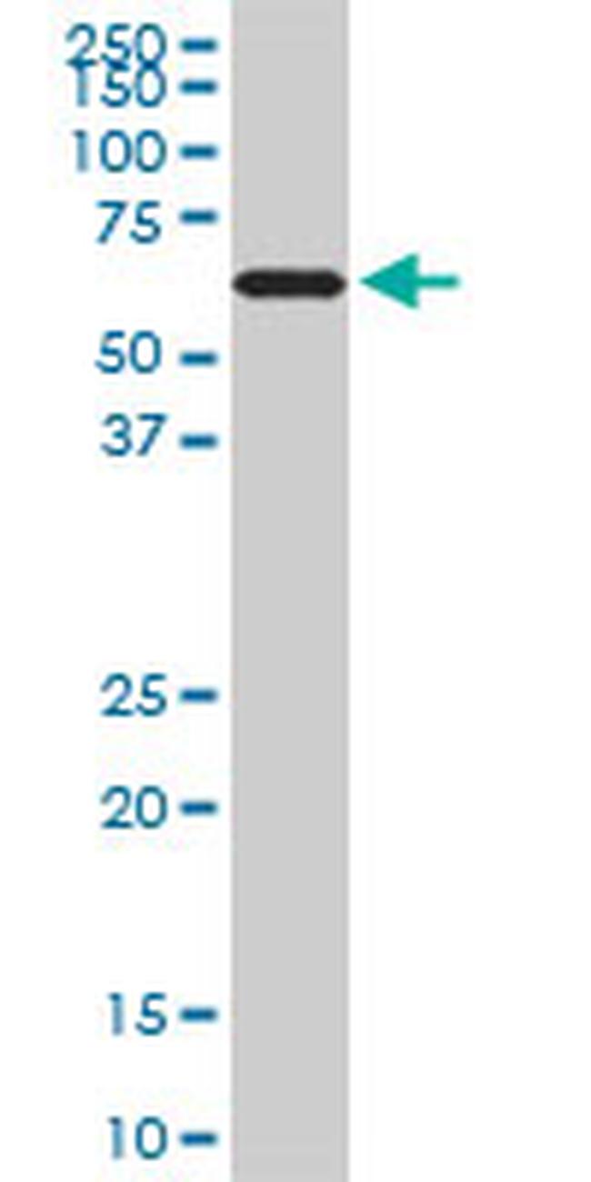 RAD18 Antibody in Western Blot (WB)