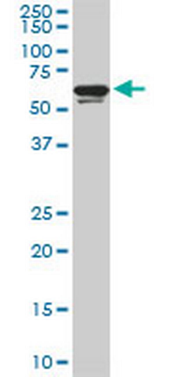 RAD18 Antibody in Western Blot (WB)