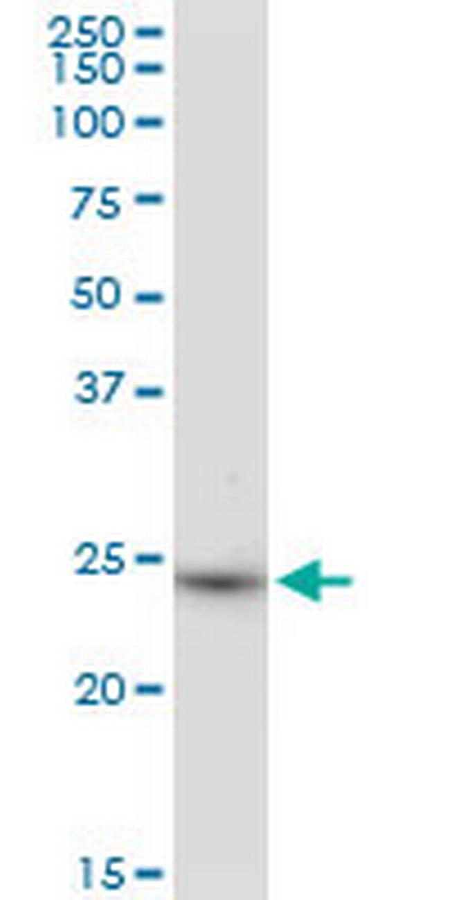 BDH2 Antibody in Western Blot (WB)