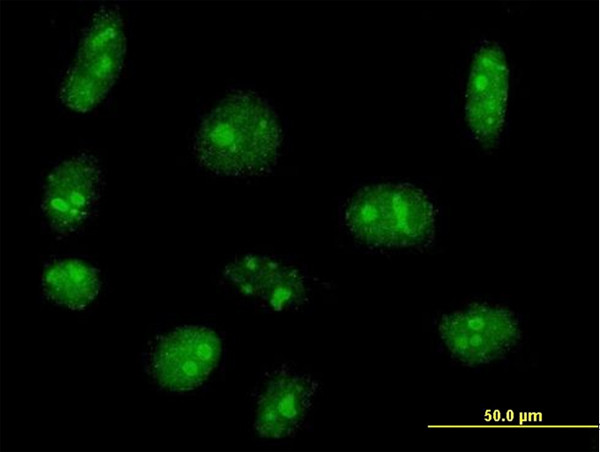 EXOSC5 Antibody in Immunocytochemistry (ICC/IF)