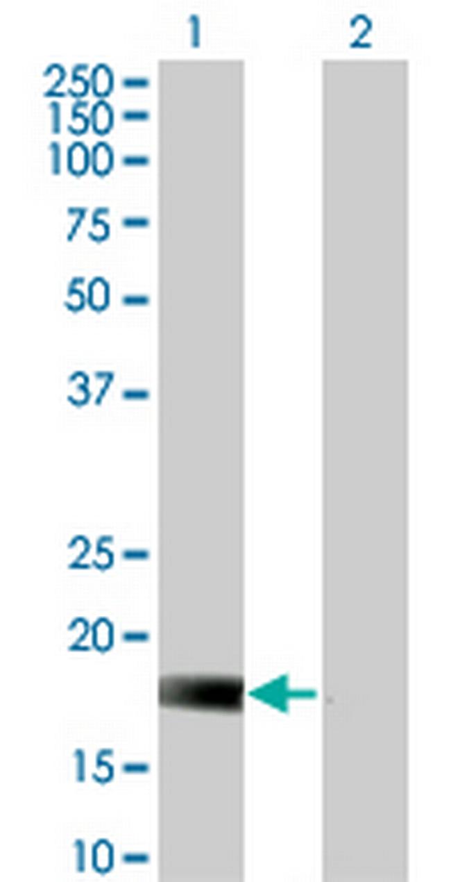 DUSP22 Antibody in Western Blot (WB)