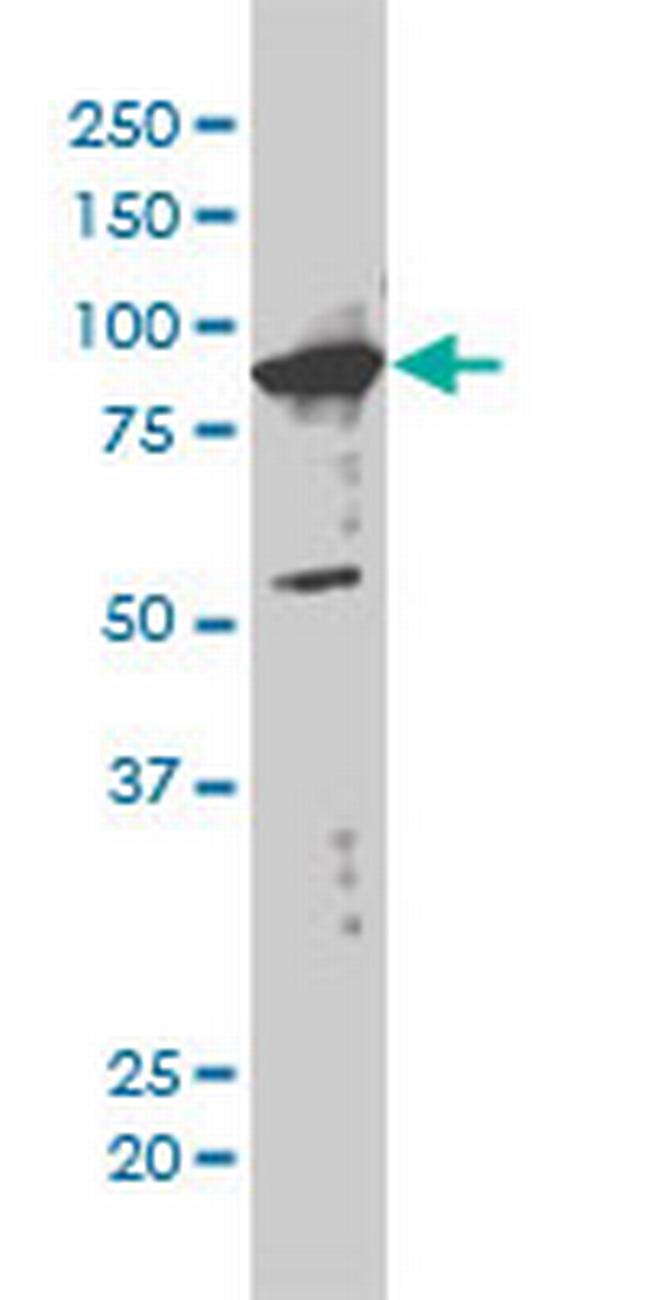 XAB2 Antibody in Western Blot (WB)