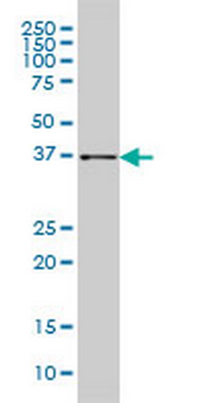 AKR1B10 Antibody in Western Blot (WB)