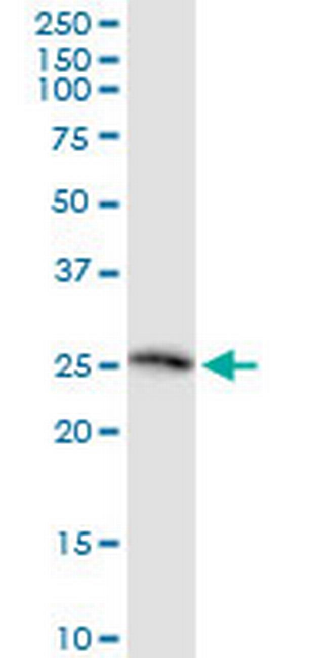 TWSG1 Antibody in Western Blot (WB)