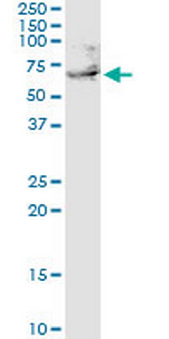 UTP3 Antibody in Western Blot (WB)