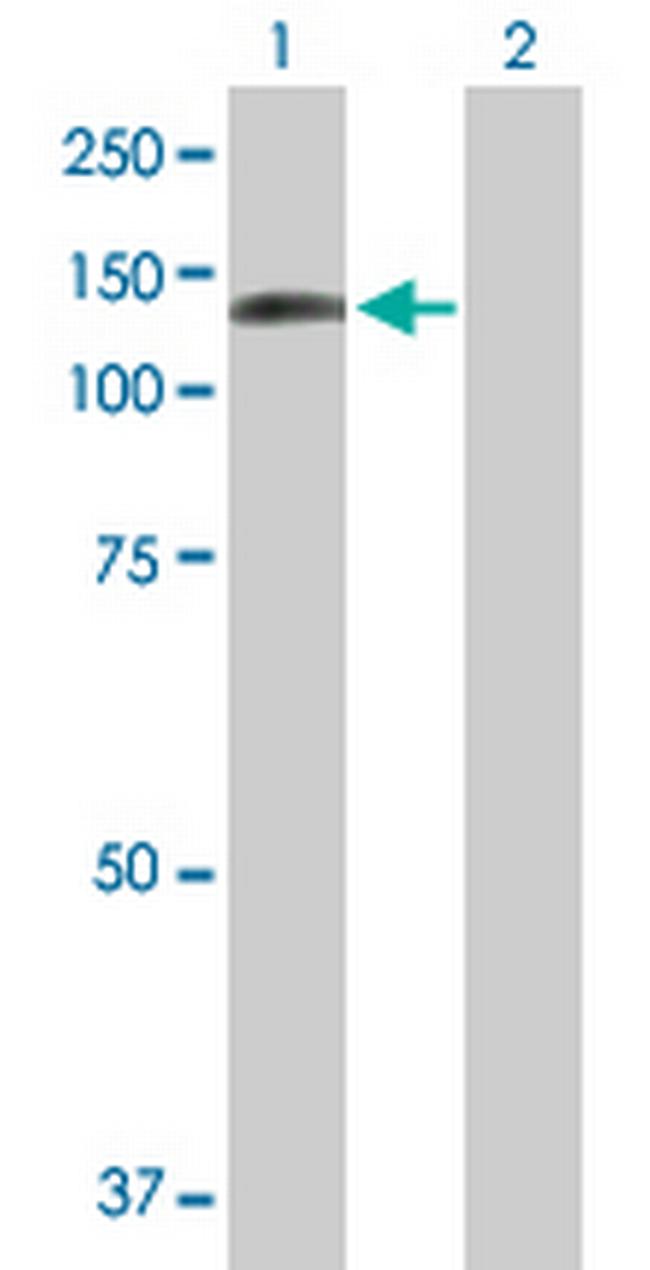 DDX24 Antibody in Western Blot (WB)