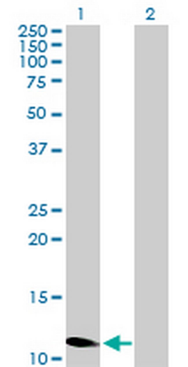 ZNF695 Antibody in Western Blot (WB)