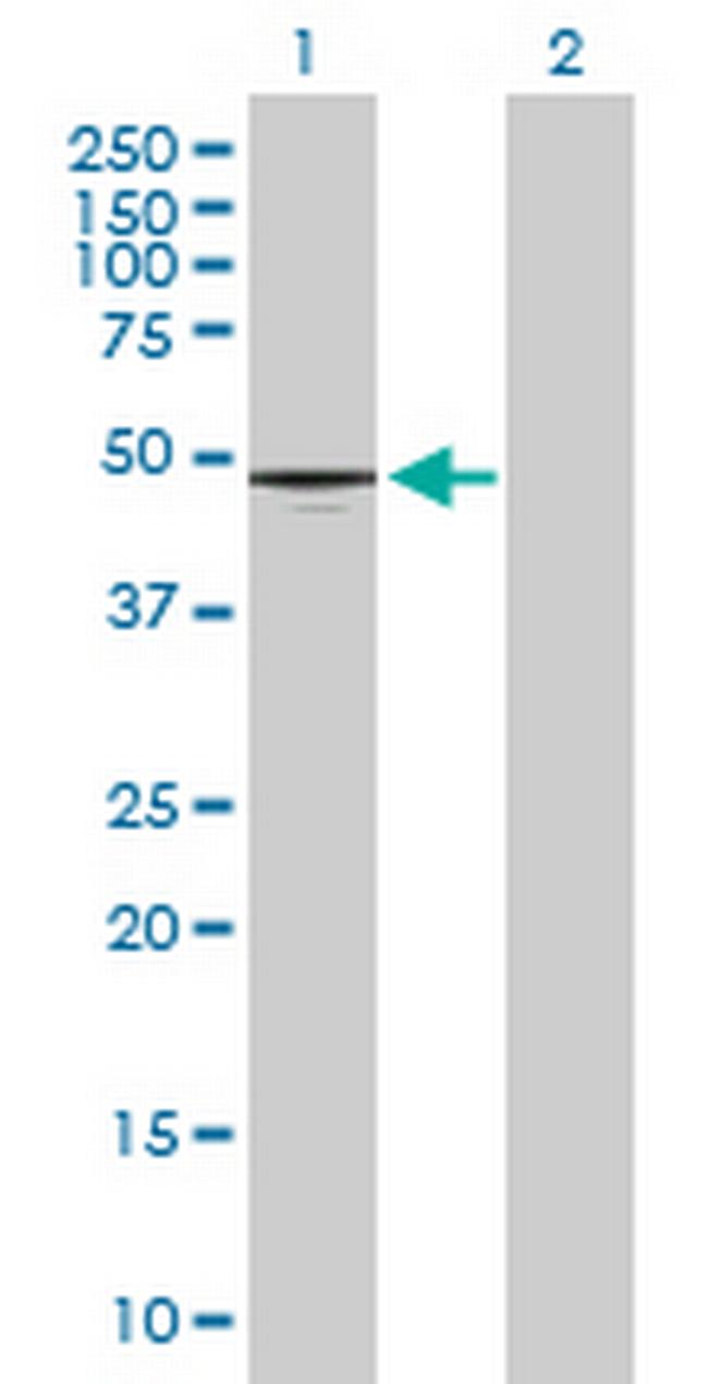 CD177 Antibody in Western Blot (WB)