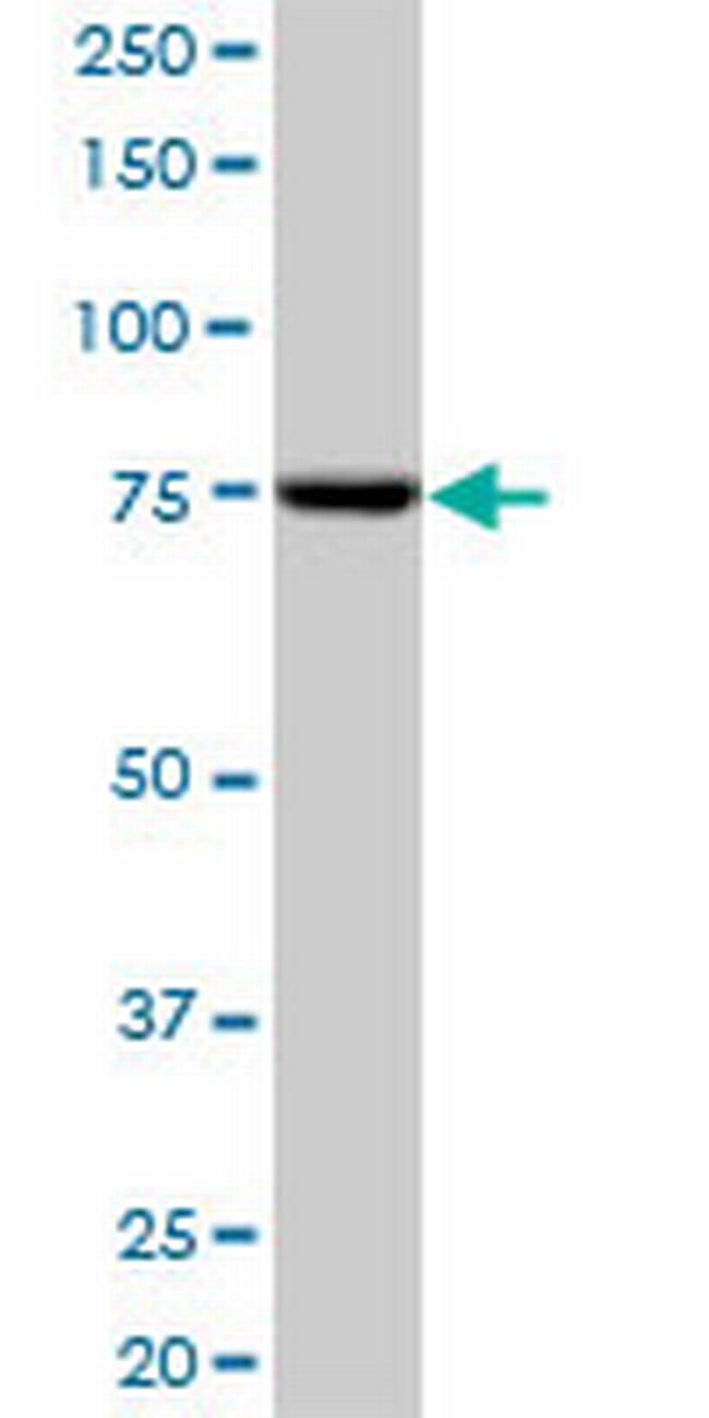 SCYL3 Antibody in Western Blot (WB)