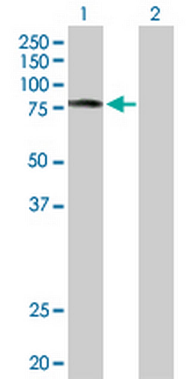 SCYL3 Antibody in Western Blot (WB)