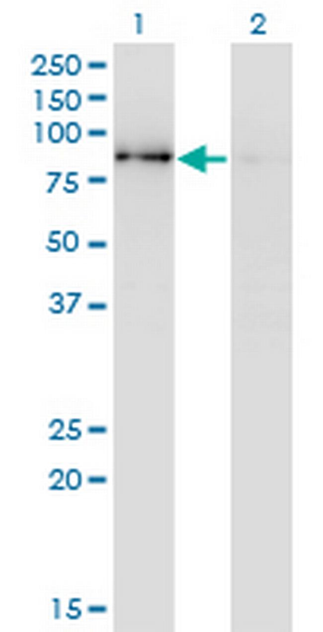 SCYL3 Antibody in Western Blot (WB)