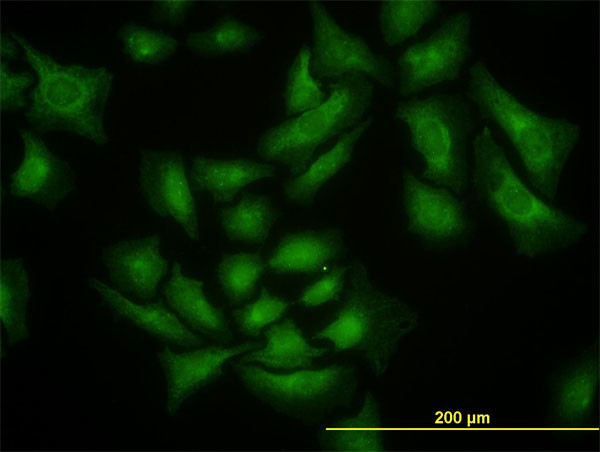 SMURF1 Antibody in Immunocytochemistry (ICC/IF)