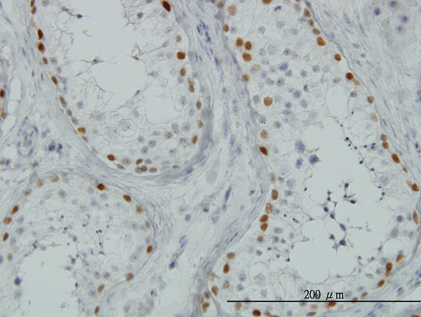 SALL4 Antibody in Immunohistochemistry (Paraffin) (IHC (P))