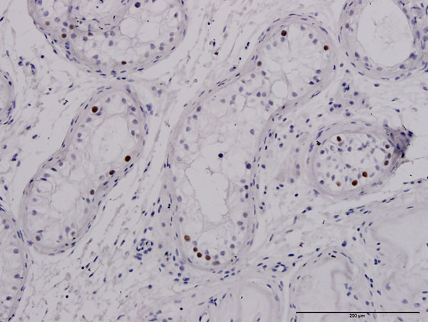 SALL4 Antibody in Immunohistochemistry (Paraffin) (IHC (P))