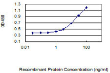 KIAA1191 Antibody in ELISA (ELISA)