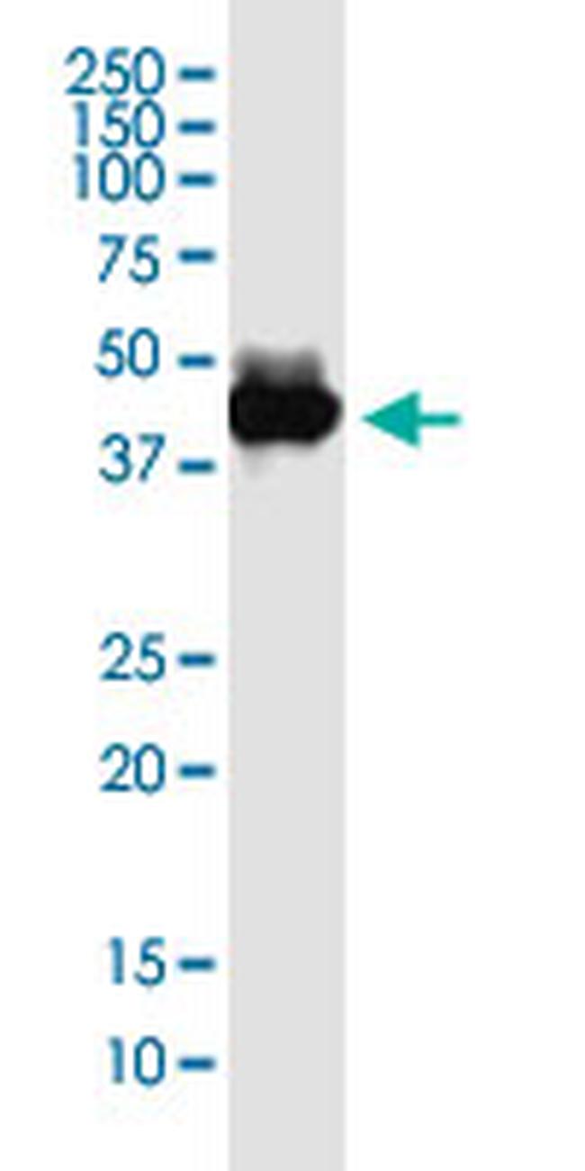 KIAA1191 Antibody in Western Blot (WB)